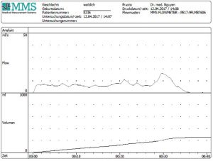 Harnstrahlmessung Diagramm klein Praxis Urologie Nguyen