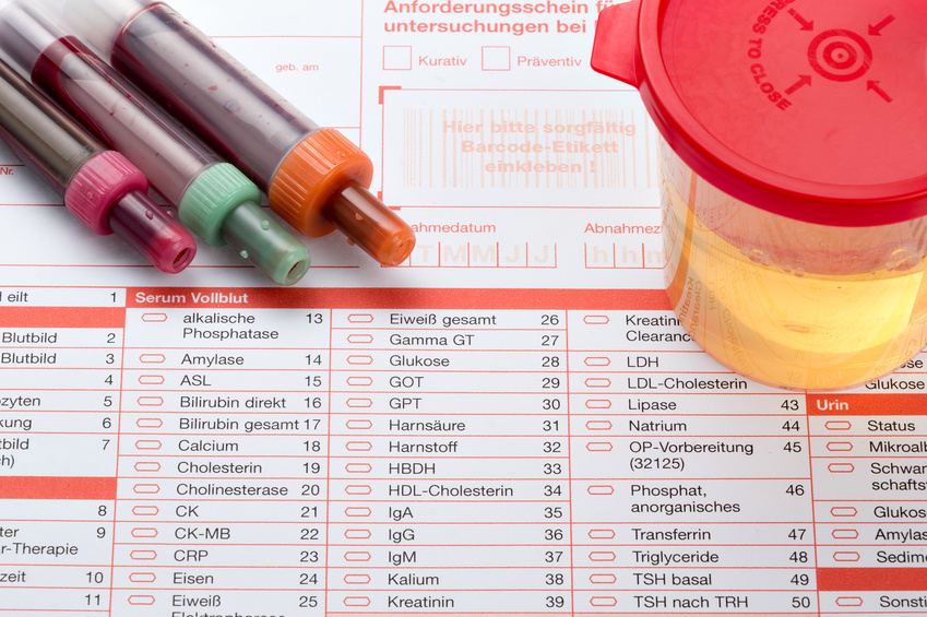 Urin-Untersuchung urologische Praxis Nguyen